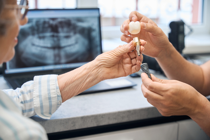 Dental Implant Services: Not Just For Senior Citizens 5