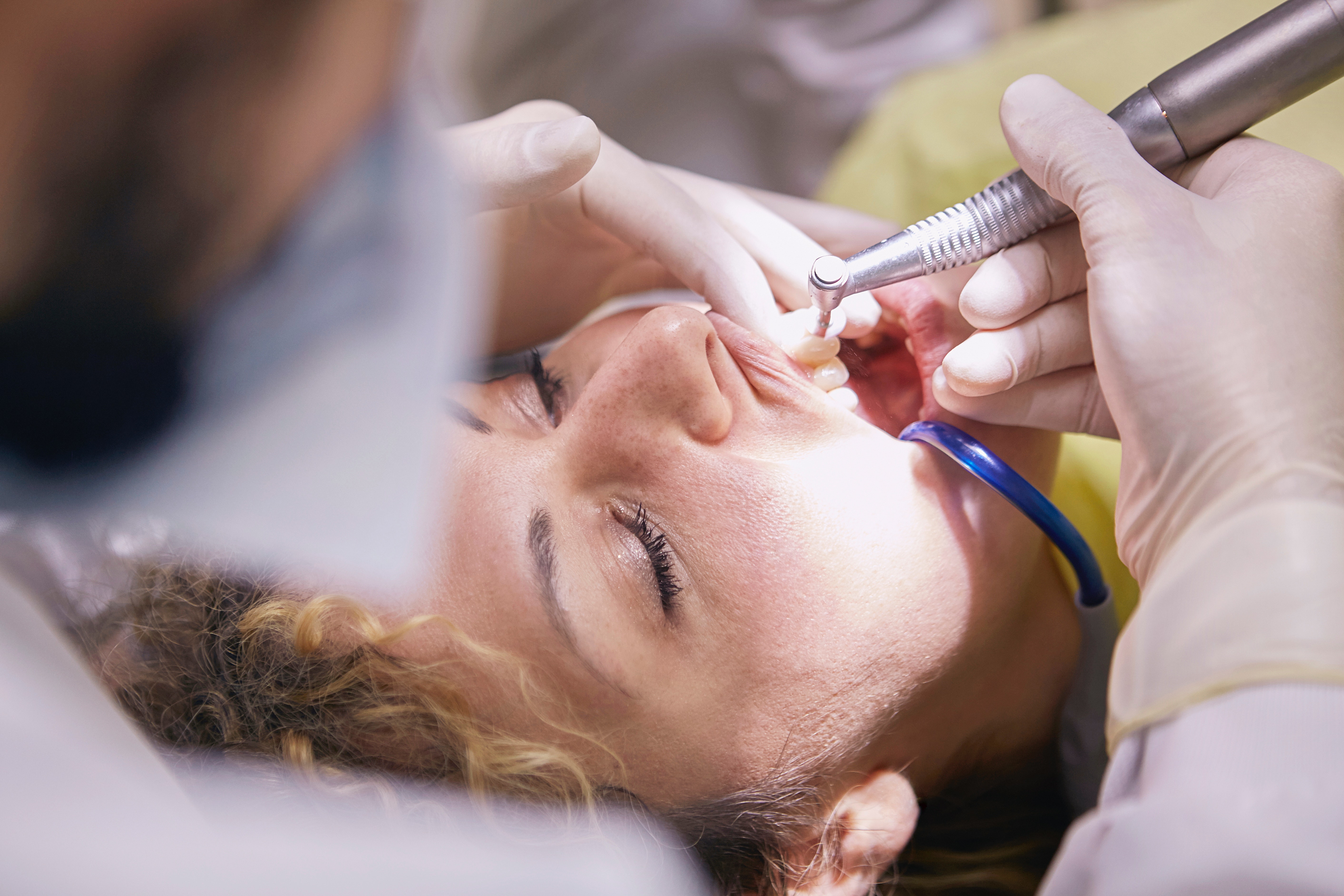 Fixing Broken Teeth and Preserving Smiles: How Our Family-Friendly Dental Office Works Wonders with Root Canals and Crowns 2