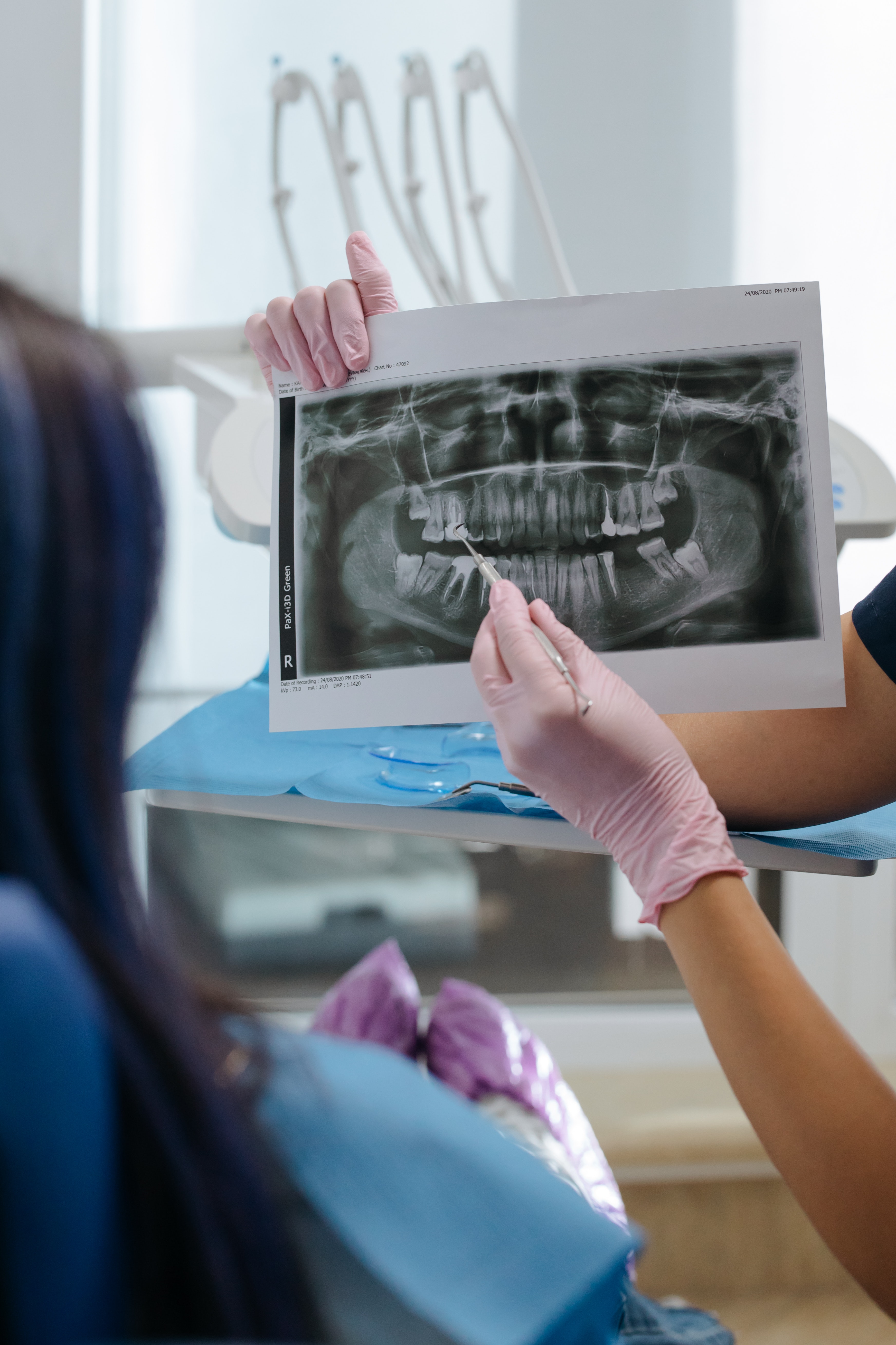 Fixing Broken Teeth and Preserving Smiles: How Our Family-Friendly Dental Office Works Wonders with Root Canals and Crowns 4