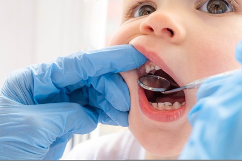 Preventive Dentistry for Kids: Tips from Our Children’s Dental Clinic 3