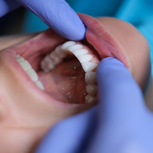 Why Your Family Friendly Dentist Office Recommends Regular Checkups & Cleanings 3