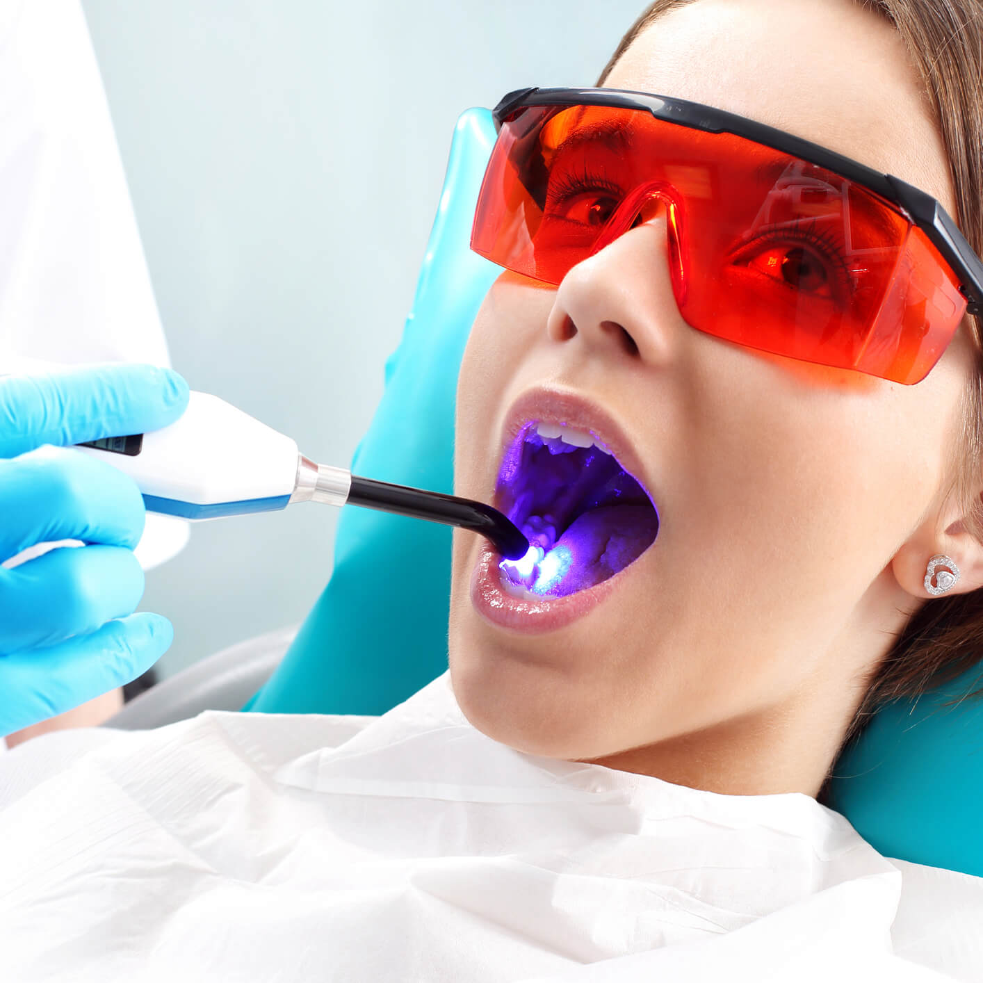 Dental fillings calgary