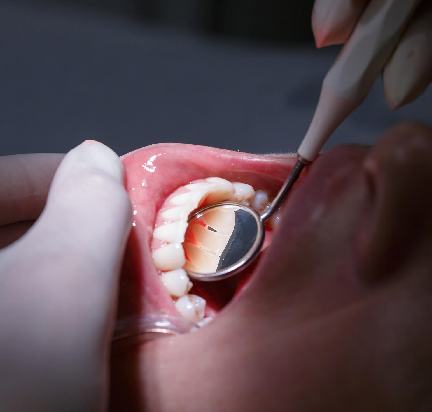 periodontal disease treatment calgary